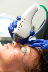 MOXI Laser by Lake Nona Ophthalmology in Orlando, FL