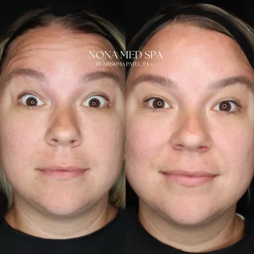 Before and After Gallery in Orlando FL