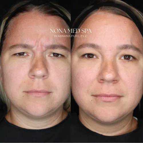 Before and After Gallery in Orlando FL