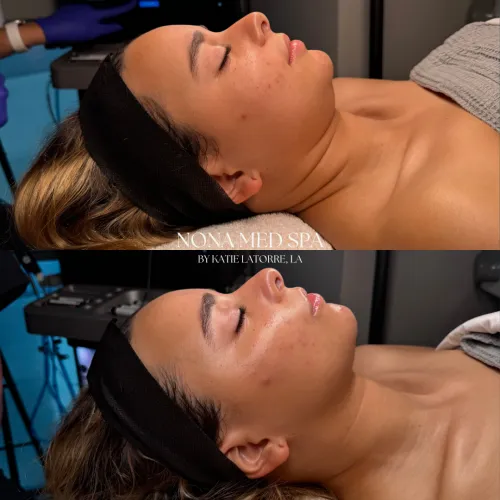 Before And After Treatment images in Orlando FL