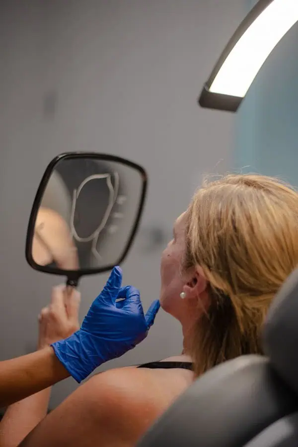 Benefits of Dermal Fillers | Nona Medspa in Orlando FL