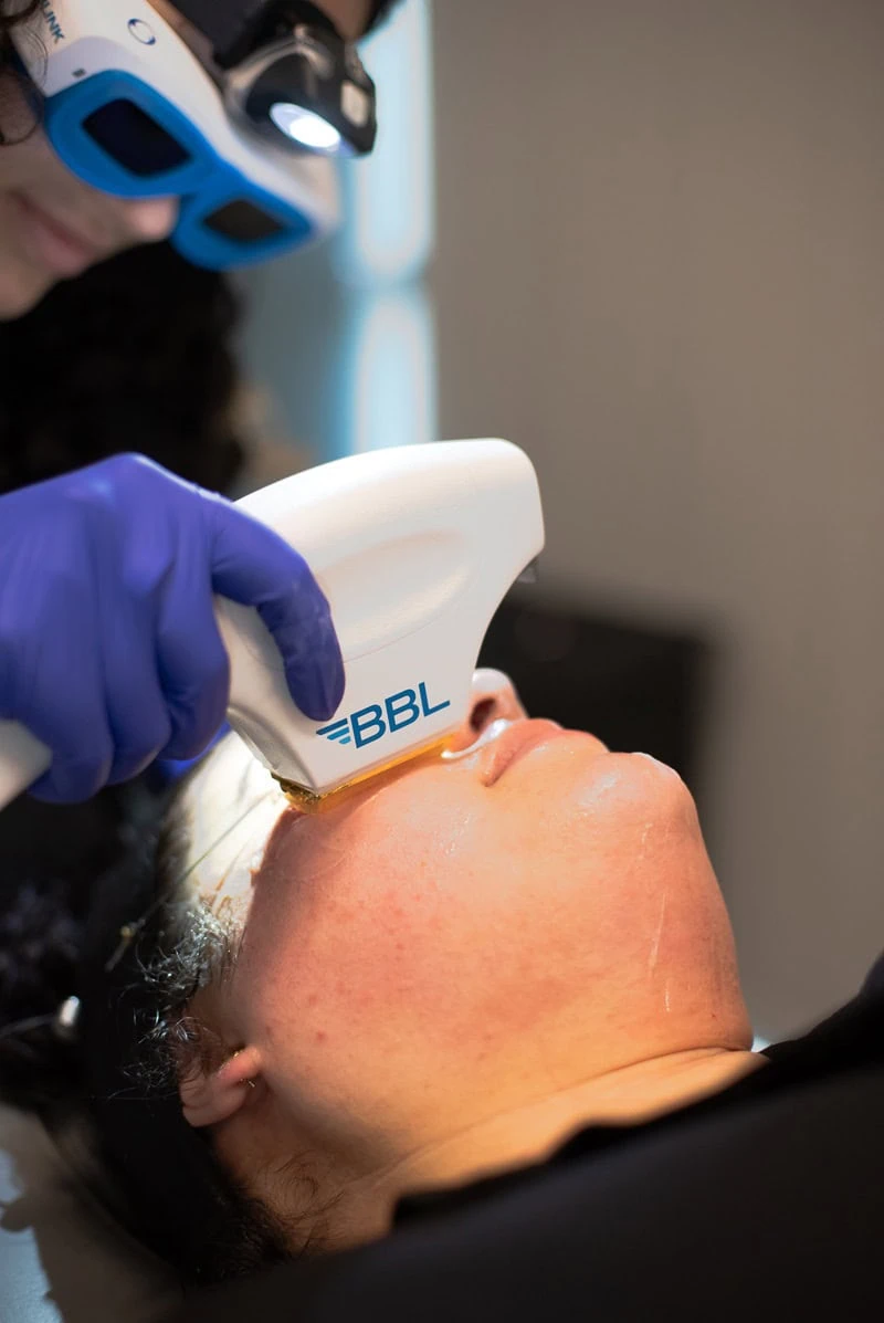 Face Beauty Treatment | IP Photo Facial Therapy in Orlando FL