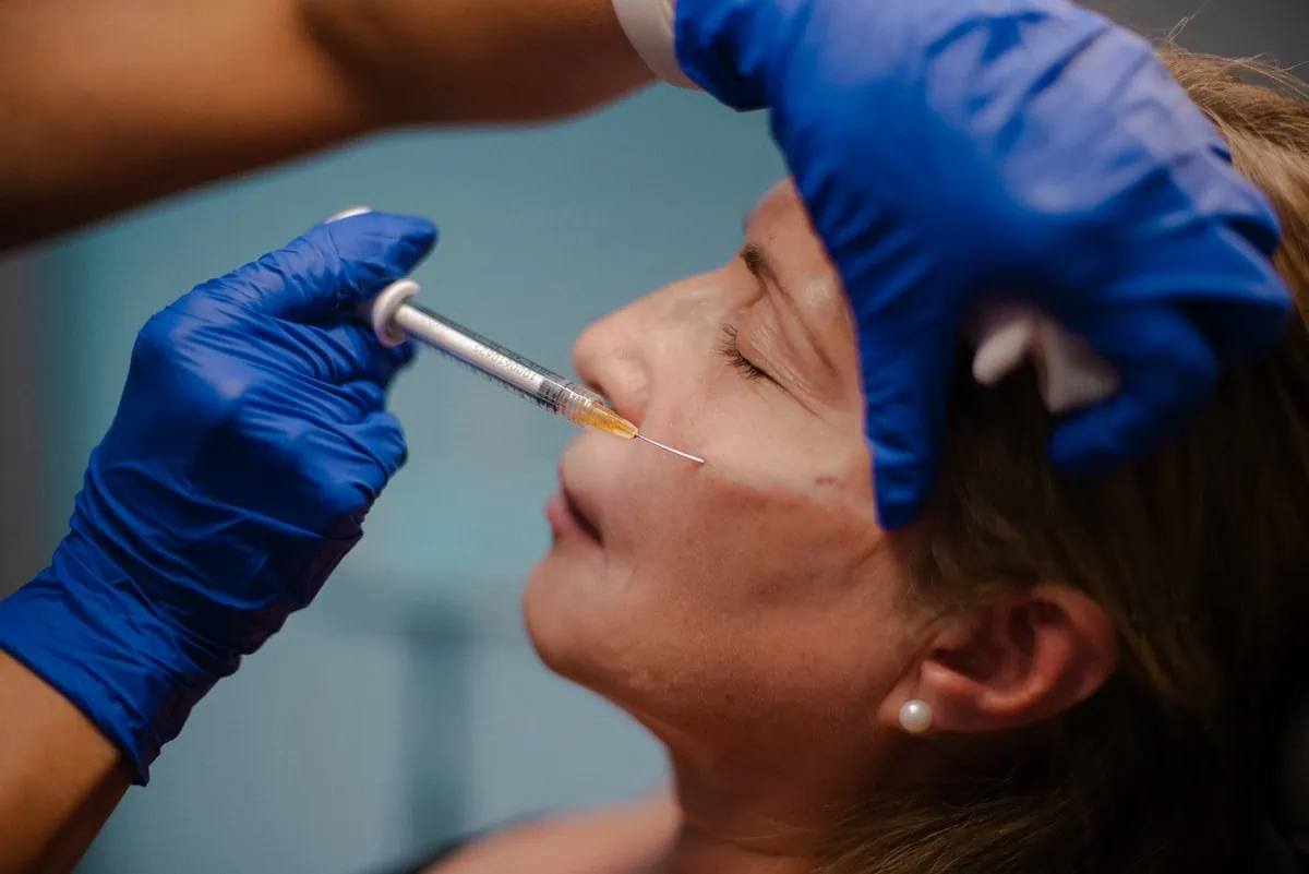 Dermal Fillers at Nona Medspa in Orlando FL