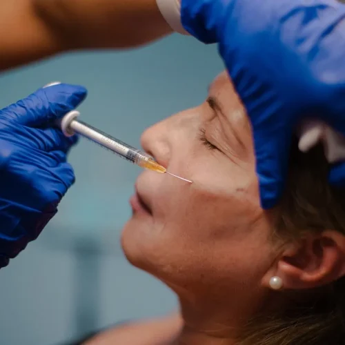 Dermal Fillers at Nona Medspa in Orlando FL